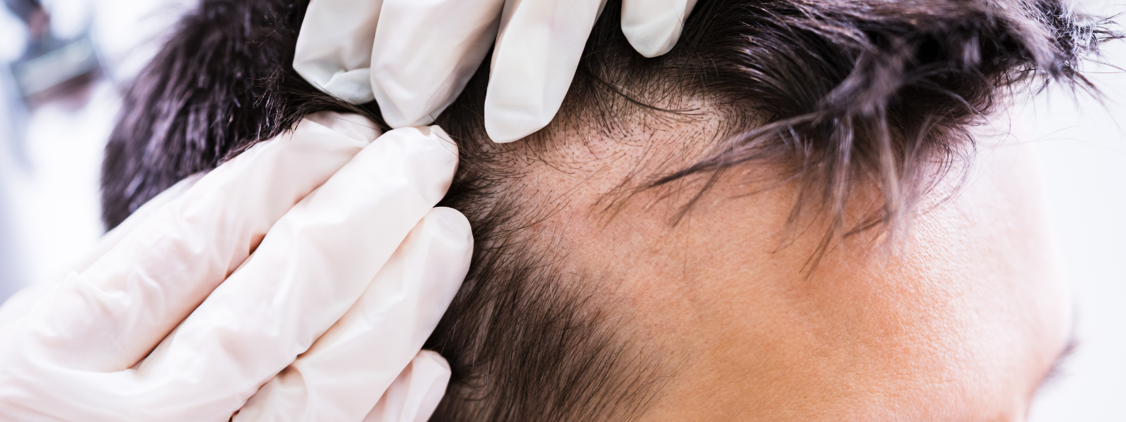 Dermatologist examines patient's head